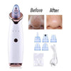 Image of Blackhead Vacuum - Blackhead Remover Vacuum